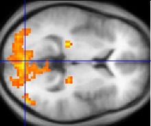 Image monochrome IRMf d'une section transversale horizontale d'un cerveau humain. Quelques régions, principalement à l'arrière, sont surlignés en orange et jaune.
