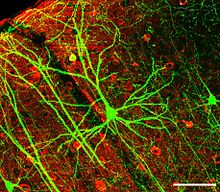 Une cellule vert clair est vu sur un fond rouge et noir, avec de longues, très ramifiées, processus verts se étendant à partir dans plusieurs directions.