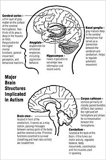 Dos diagramas de las principales estructuras cerebrales implicadas en el autismo. El diagrama superior muestra la corteza cerebral cerca de la parte superior y los ganglios basales en el centro, justo por encima de la amígdala y el hipocampo. El diagrama inferior muestra el cuerpo calloso, cerca del centro, del cerebelo en la parte inferior trasera, y el tallo cerebral en la parte inferior central.