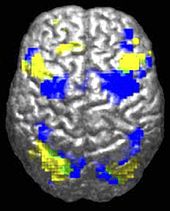 Un cerebro humano se ve desde arriba. Alrededor del 10% se resalta en amarillo y 10% en azul. Sólo hay un pequeño (quizás 0,5%) región verde donde se superponen.